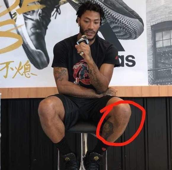 NBA球星伤疤有多恐怖？罗斯膝盖伤疤10厘米，看到老詹我服了(2)