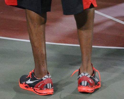 NBA球星伤疤有多恐怖？罗斯膝盖伤疤10厘米，看到老詹我服了(4)